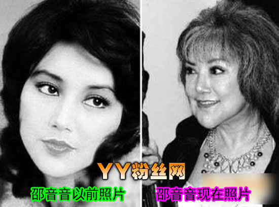 邵音音年輕照片演過(guò)的三級(jí)有哪些 邵音音整容前后照片對(duì)比失敗插圖3